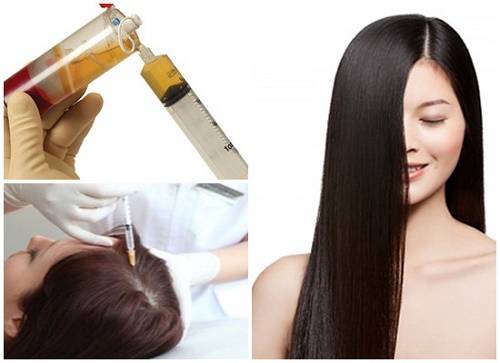 Điều trị rụng tóc