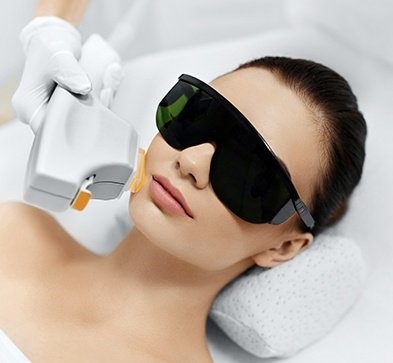 ĐIỀU TRỊ  RÁM MÁ, TĂNG SẮC DA TỐ BẰNG ÁNH SÁNG XUNG CƯỜNG ĐỘ CAO  (INTENSE PULSE LIGHT – IPL)