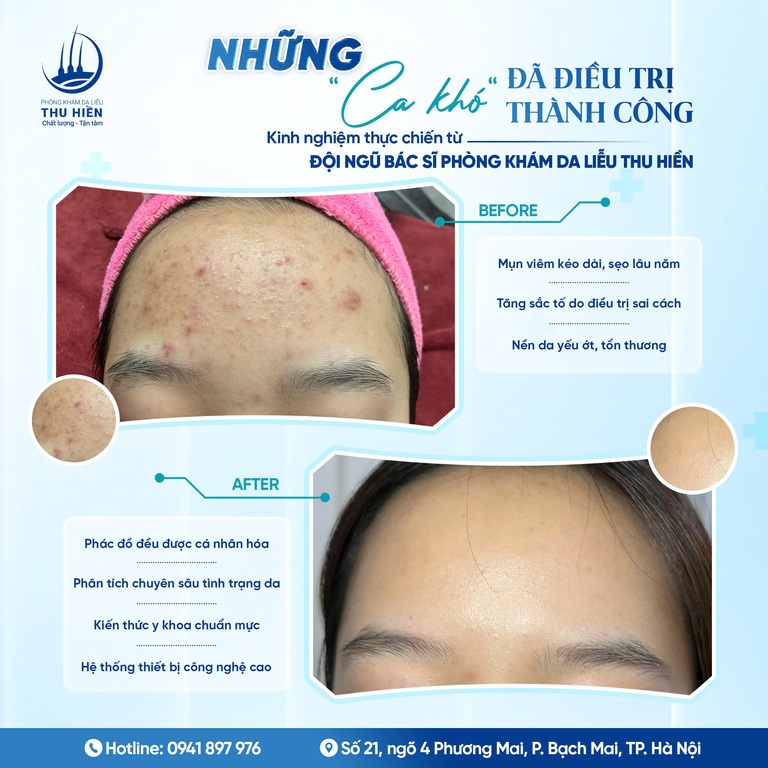 NHỮNG “CA KHÓ” ĐÃ ĐIỀU TRỊ THÀNH CÔNG