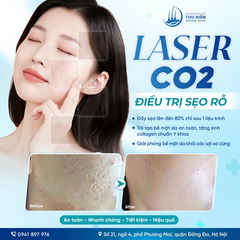 LASER CO2 ĐIỀU TRỊ SẸO RỖ | Feedback chân thực từng khách hàng