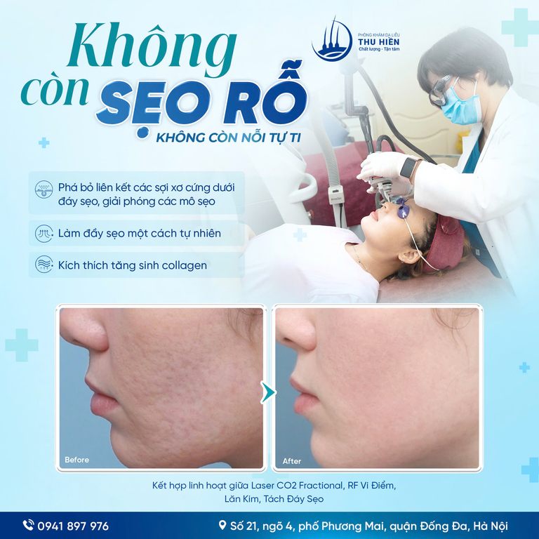 KHÔNG CÒN SẸO RỖ – KHÔNG CÒN NỖI TỰ TI