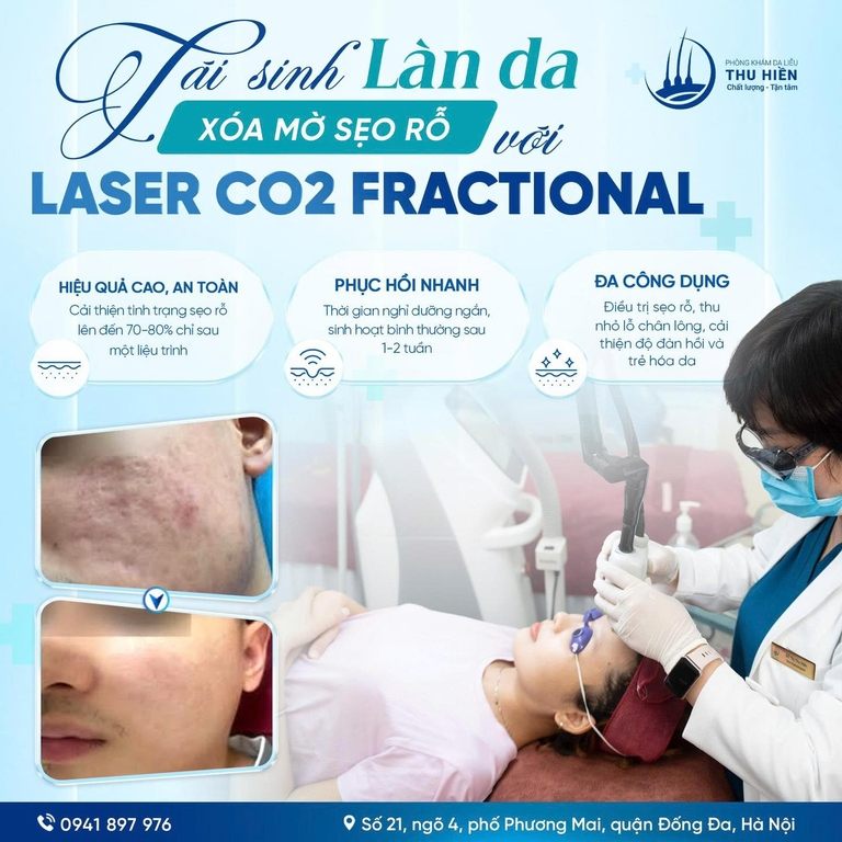 TÁI SINH LÀN DA - XÓA MỜ S.ẸO RỖ VỚI LASER CO2 FRACTIONAL