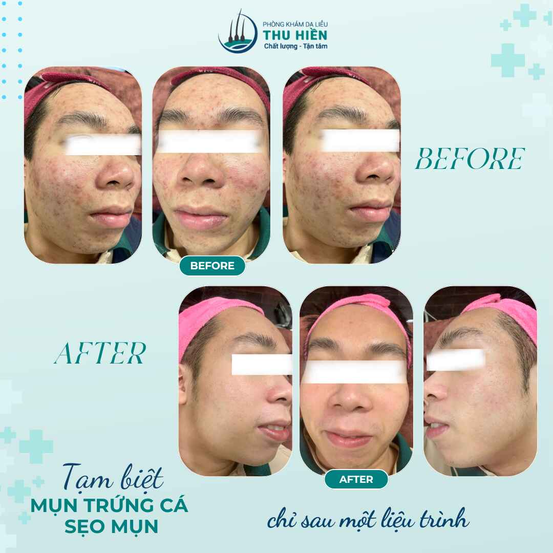  DESIGNER CUỐI TUẦN CHƯA LÀM KỊP ẢNH ĐỂ UP À? Không sao đâu vì…