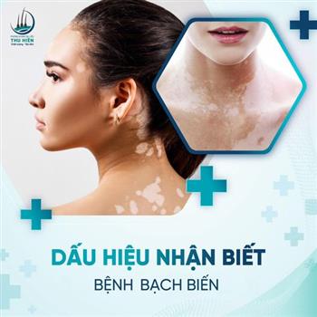 ĐÂU LÀ NHỮNG ĐẶC ĐIỂM BÁO HIỆU BỆNH BẠCH BIẾN?