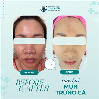 Chúng tôi luôn đồng hành cùng khách hàng trên hành trình lấy lại vẻ đẹp của làn da