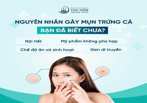  MỤN TRỨNG CÁ - 
