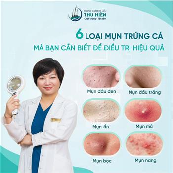 6 LOẠI MỤN MÀ BẠN CẦN BIẾT ĐỂ ĐIỀU TRỊ TRỨNG CÁ TẬN GỐC