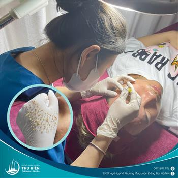 💢 BẠN CÓ BIẾT KHÔNG PHẢI LOẠI MỤN NÀO CŨNG CÓ THỂ LẤY ĐƯỢC NHÂN?