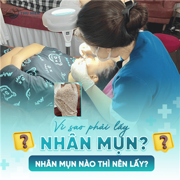 [ HỎI ĐÁP CÙNG BÁC SĨ] Vì sao phải lấy nhân mụn, nhân mụn nào thì nên lấy