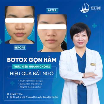 💉 BOTOX GỌN HÀM | THỰC HIỆN NHANH CHÓNG - HIỆU QUẢ BẤT NGỜ