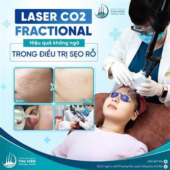 LASER CO2 FRACTIONAL | H.iệu q.uả không ngờ trong điều trị s.ẹo rỗ