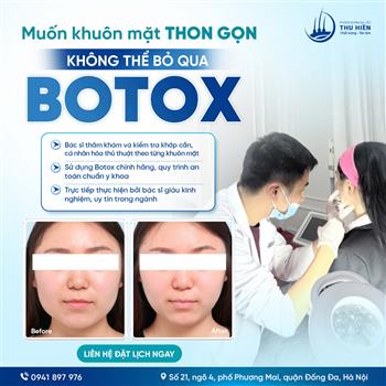 MUỐN KHUÔN MẶT THON GỌN KHÔNG THỂ BỎ QUA BOTOX 