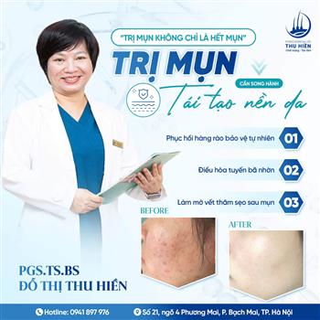 Trị m.ụn không chỉ là hết m.ụn